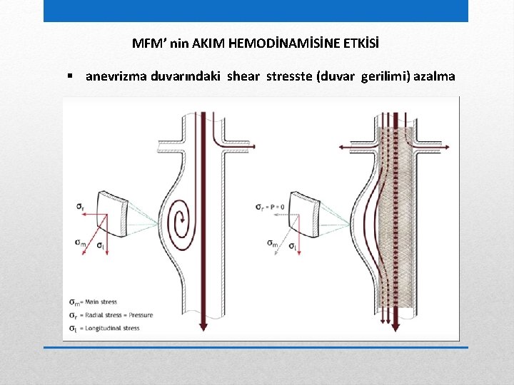 MFM’ nin AKIM HEMODİNAMİSİNE ETKİSİ § anevrizma duvarındaki shear stresste (duvar gerilimi) azalma 