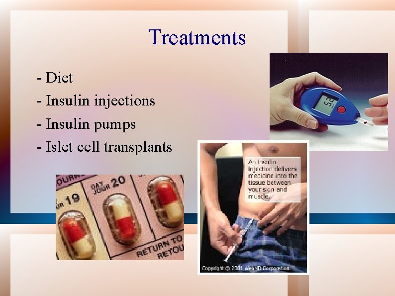 Treatments - Diet - Insulin injections - Insulin pumps - Islet cell transplants 