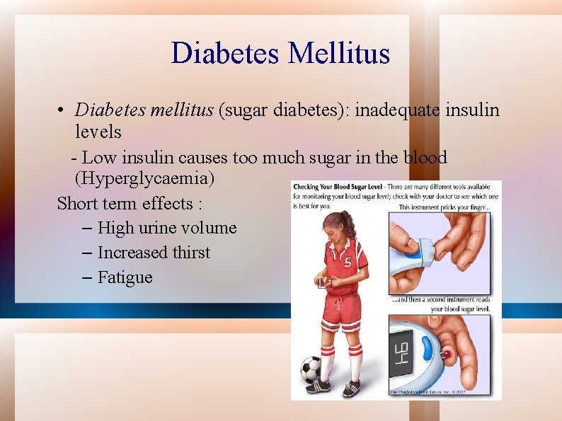Diabetes Mellitus • Diabetes mellitus (sugar diabetes): inadequate insulin levels - Low insulin causes