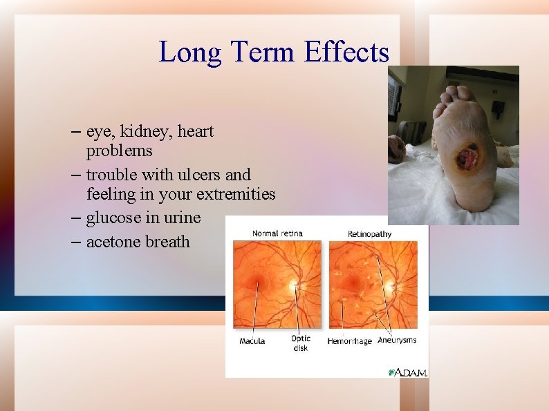 Long Term Effects – eye, kidney, heart problems – trouble with ulcers and feeling