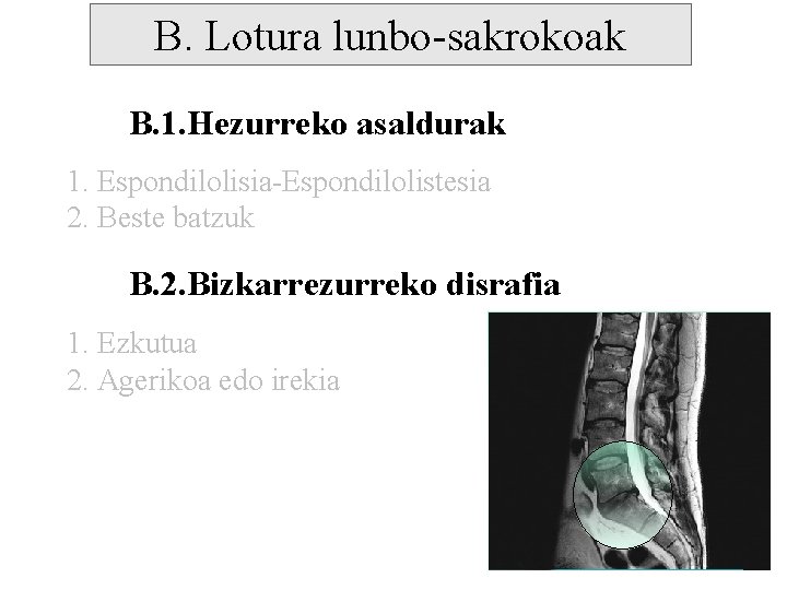 B. Lotura lunbo-sakrokoak B. 1. Hezurreko asaldurak 1. Espondilolisia-Espondilolistesia 2. Beste batzuk B. 2.