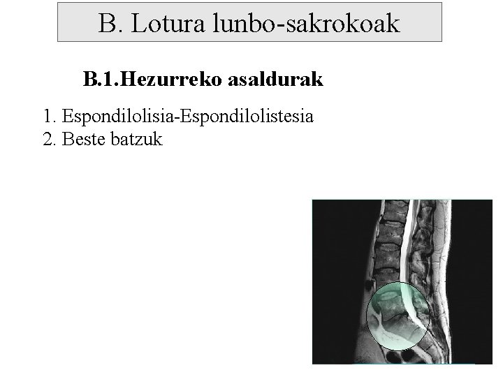 B. Lotura lunbo-sakrokoak B. 1. Hezurreko asaldurak 1. Espondilolisia-Espondilolistesia 2. Beste batzuk 