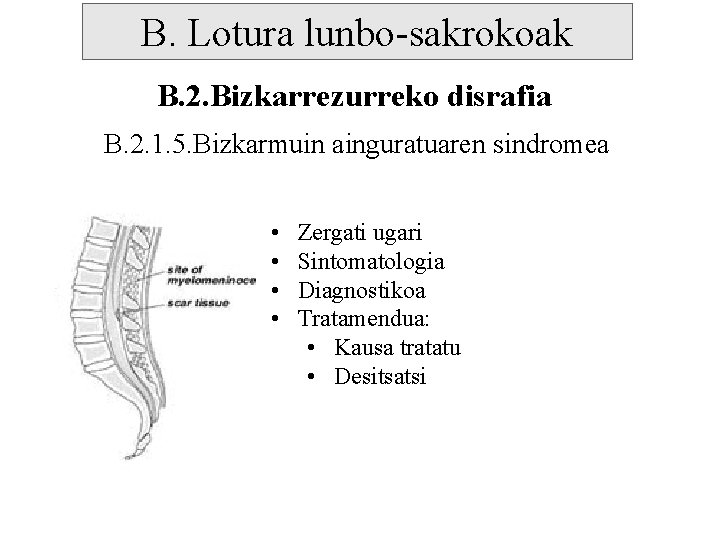 B. Lotura lunbo-sakrokoak B. 2. Bizkarrezurreko disrafia B. 2. 1. 5. Bizkarmuin ainguratuaren sindromea