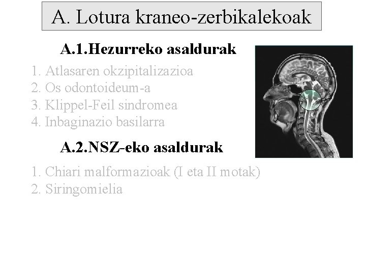 A. Lotura kraneo-zerbikalekoak A. 1. Hezurreko asaldurak 1. Atlasaren okzipitalizazioa 2. Os odontoideum-a 3.