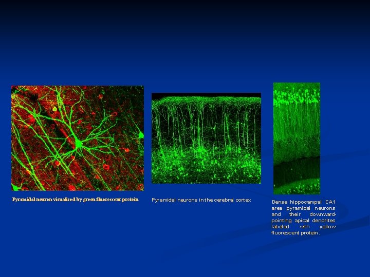 Pyramidal neuron visualized by green fluorescent protein Pyramidal neurons in the cerebral cortex Dense
