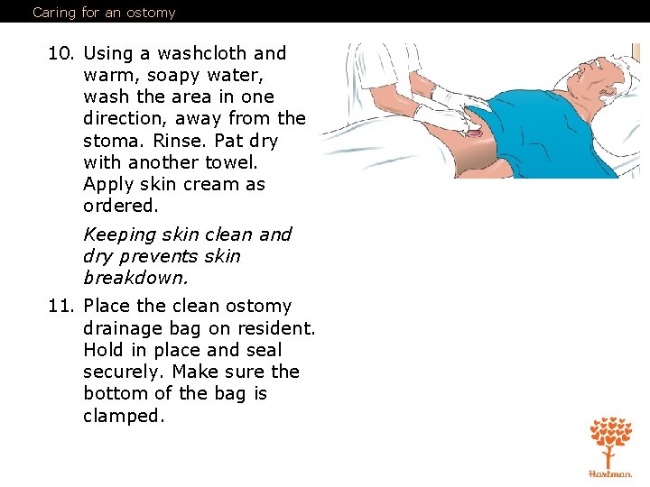 Caring for an ostomy 10. Using a washcloth and warm, soapy water, wash the