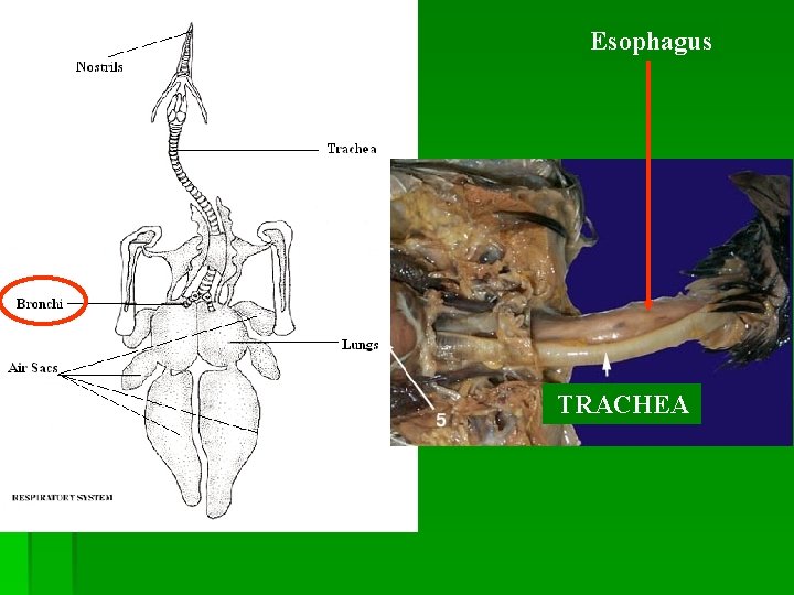 Esophagus TRACHEA 