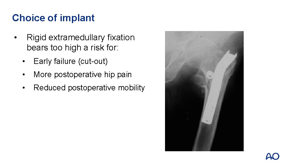 Choice of implant • Rigid extramedullary fixation bears too high a risk for: •