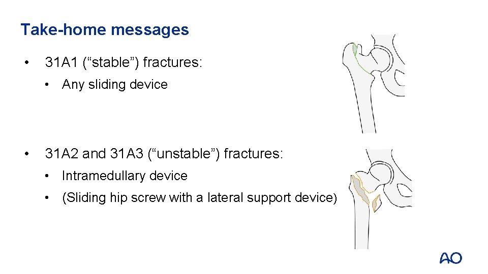 Take-home messages • 31 A 1 (“stable”) fractures: • Any sliding device • 31