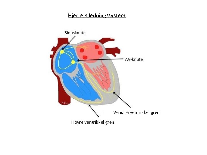 Hjertets ledningssystem Venstre ventrikkel gren Høyre ventrikkel gren 