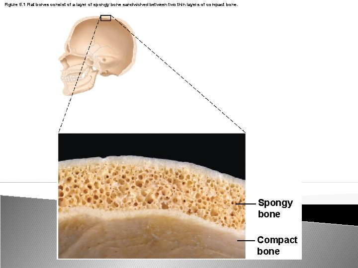 Figure 5. 1 Flat bones consist of a layer of spongy bone sandwiched between