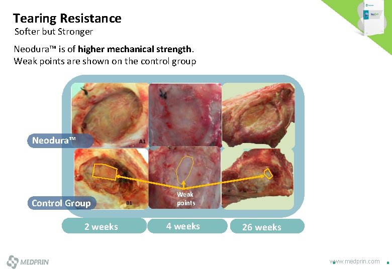 Tearing Resistance Softer but Stronger Neodura™ is of higher mechanical strength. Weak points are