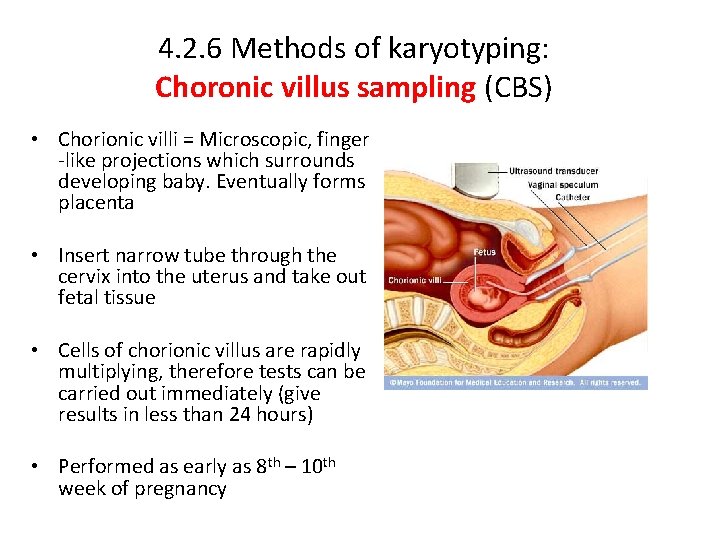 4. 2. 6 Methods of karyotyping: Choronic villus sampling (CBS) • Chorionic villi =