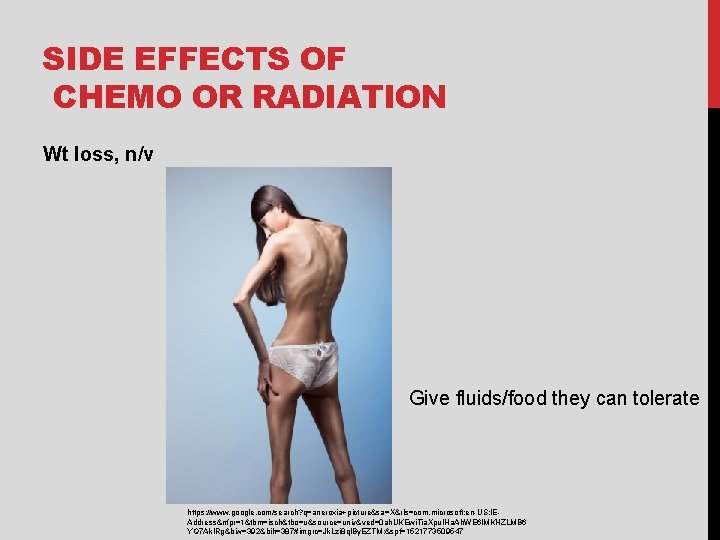 SIDE EFFECTS OF CHEMO OR RADIATION Wt loss, n/v Give fluids/food they can tolerate