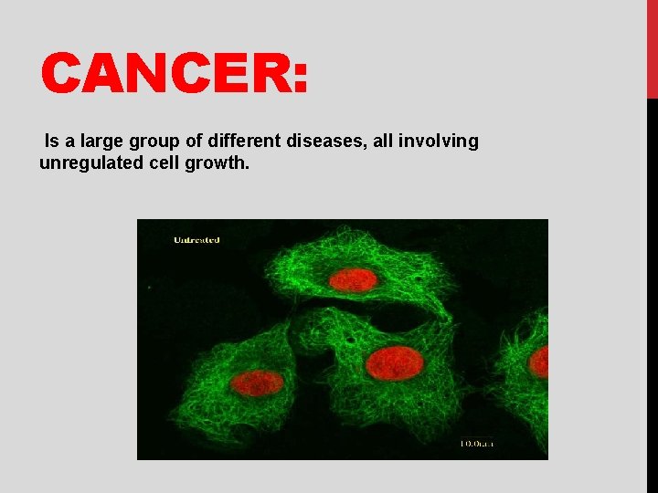 CANCER: Is a large group of different diseases, all involving unregulated cell growth. 