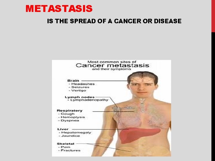 METASTASIS IS THE SPREAD OF A CANCER OR DISEASE 