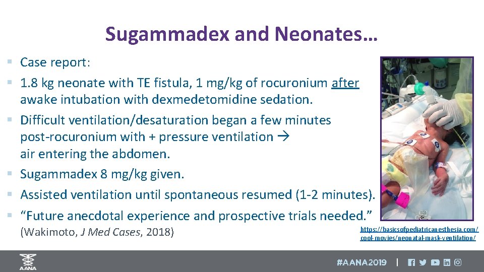 Sugammadex and Neonates… § Case report: § 1. 8 kg neonate with TE fistula,