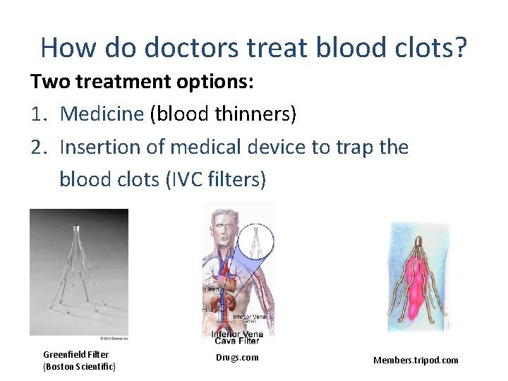 How do doctors treat blood clots? Two treatment options: 1. Medicine (blood thinners) 2.
