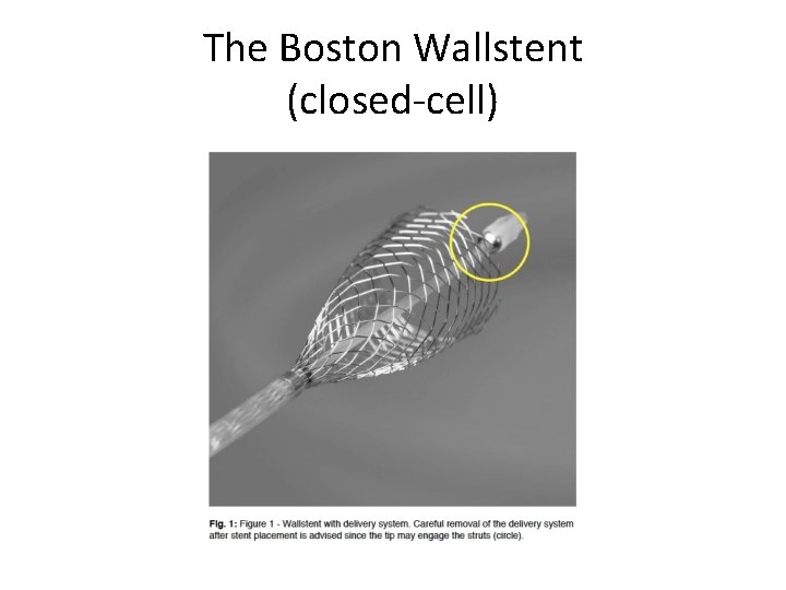 The Boston Wallstent (closed-cell) 
