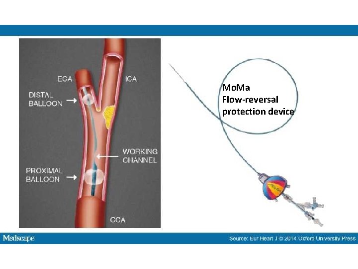 Mo. Ma Flow-reversal protection device 