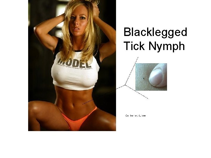Blacklegged Tick Nymph 