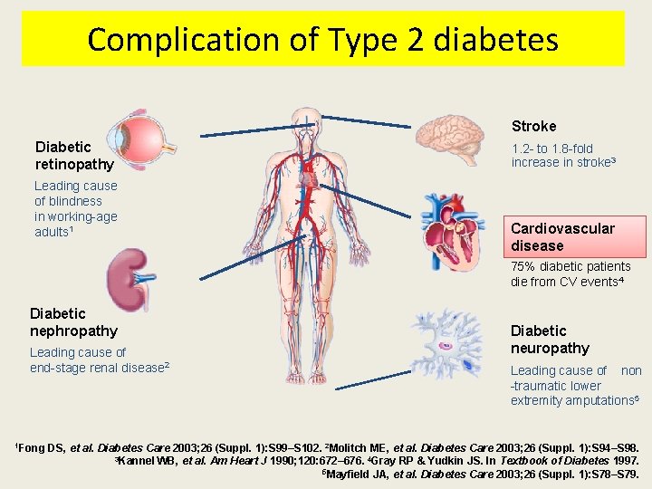 Complication of Type 2 diabetes Stroke Diabetic retinopathy Leading cause of blindness in working-age Complication of Type 2 diabetes Stroke Diabetic retinopathy Leading cause of blindness in working-age