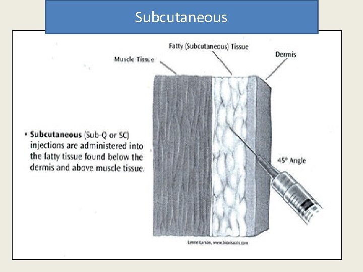 Subcutaneous  Subcutaneous