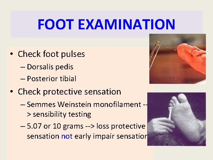 FOOT EXAMINATION • Check foot pulses – Dorsalis pedis – Posterior tibial • Check FOOT EXAMINATION • Check foot pulses – Dorsalis pedis – Posterior tibial • Check