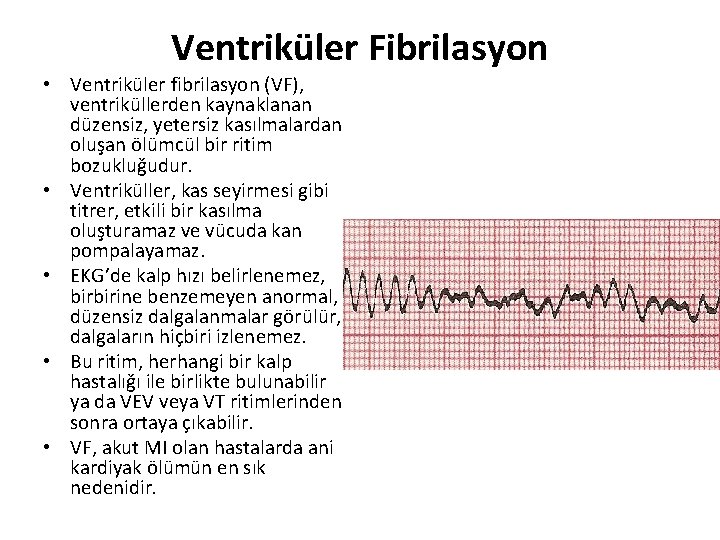 Ventriküler Fibrilasyon • Ventriküler fibrilasyon (VF), ventriküllerden kaynaklanan düzensiz, yetersiz kasılmalardan oluşan ölümcül bir