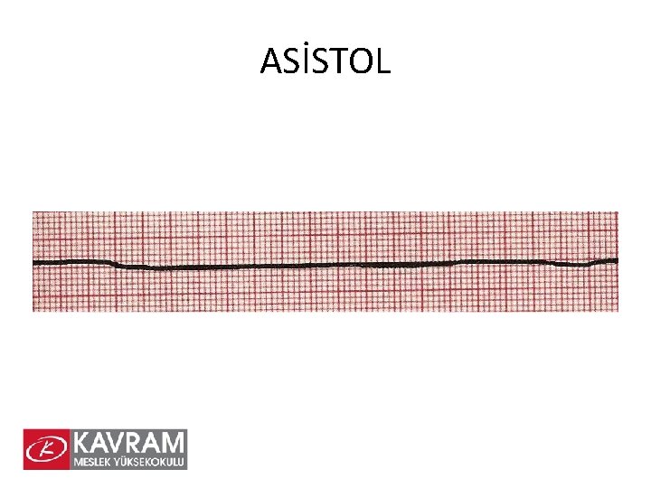 ASİSTOL 