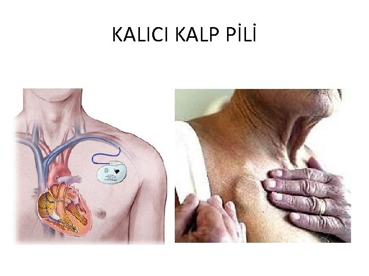 KALICI KALP PİLİ 