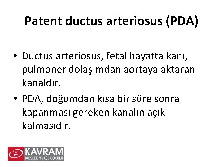 Patent ductus arteriosus (PDA) • Ductus arteriosus, fetal hayatta kanı, pulmoner dolaşımdan aortaya aktaran