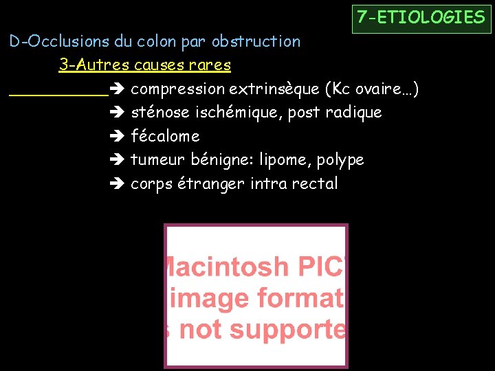 7 -ETIOLOGIES D-Occlusions du colon par obstruction 3 -Autres causes rares compression extrinsèque (Kc