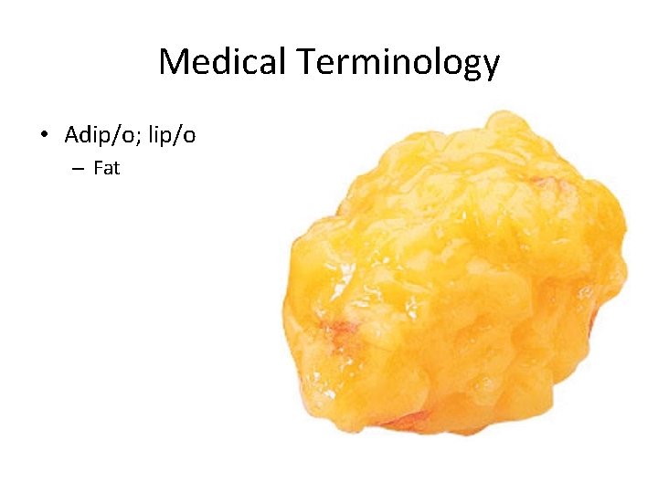 Medical Terminology • Adip/o; lip/o – Fat 