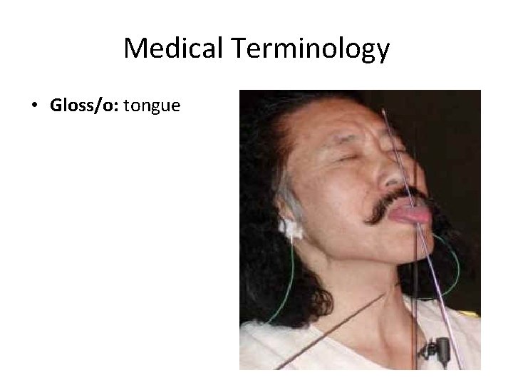 Medical Terminology • Gloss/o: tongue 