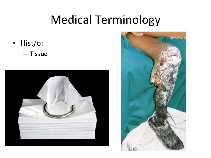 Medical Terminology • Hist/o: – Tissue 