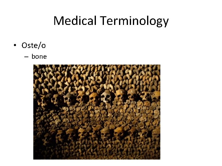Medical Terminology • Oste/o – bone 