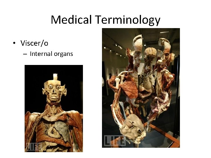 Medical Terminology • Viscer/o – Internal organs 