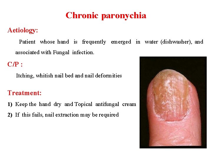 Chronic paronychia Aetiology: Patient whose hand is frequently emerged in water (dishwasher), and associated