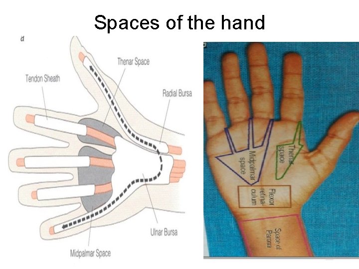 Spaces of the hand 