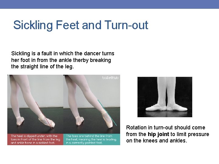 Sickling Feet and Turn-out Sickling is a fault in which the dancer turns her