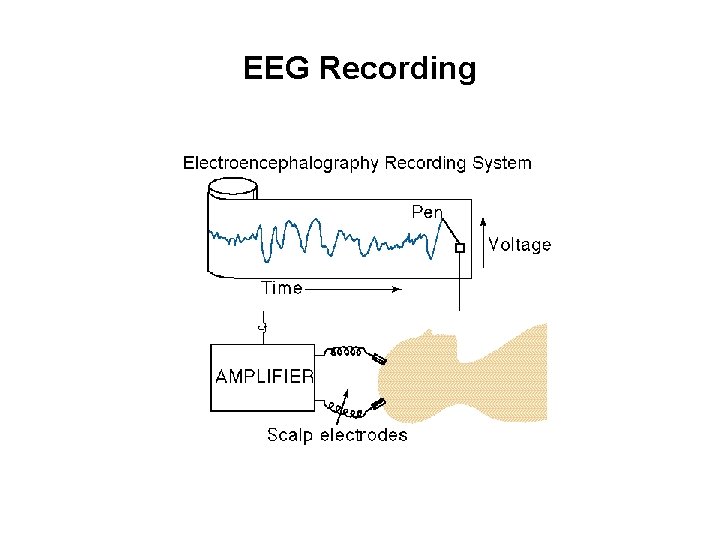 EEG Recording 