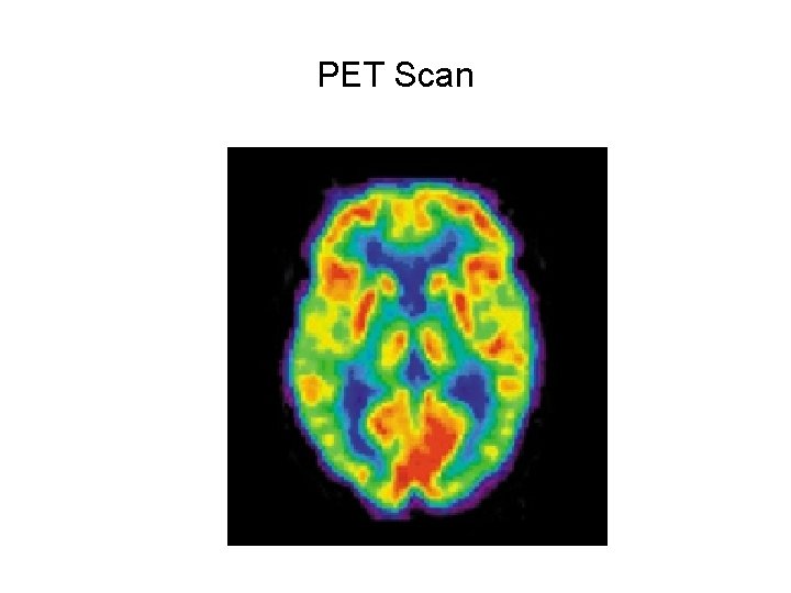 PET Scan 