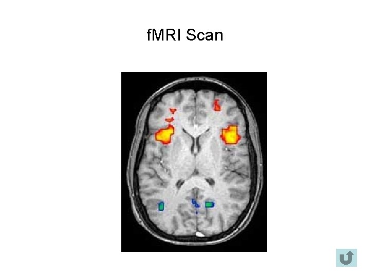f. MRI Scan 