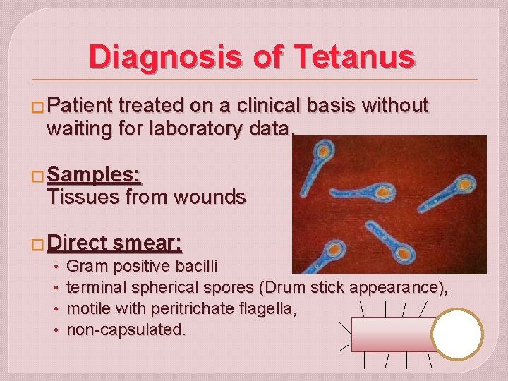 Diagnosis of Tetanus � Patient treated on a clinical basis without waiting for laboratory