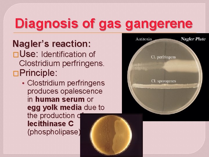 Diagnosis of gas gangerene Nagler’s reaction: �Use: Identification of Clostridium perfringens. �Principle: • Clostridium