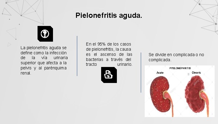 Pielonefritis aguda. La pielonefritis aguda se define como la infección de la vía urinaria
