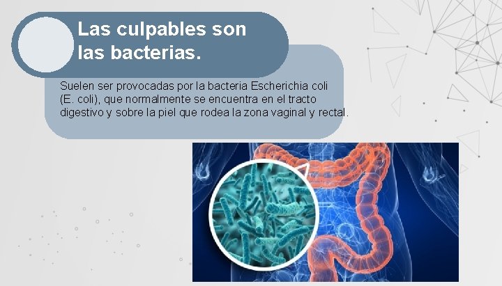 Las culpables son las bacterias. Suelen ser provocadas por la bacteria Escherichia coli (E.