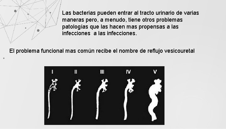 Las bacterias pueden entrar al tracto urinario de varias maneras pero, a menudo, tiene