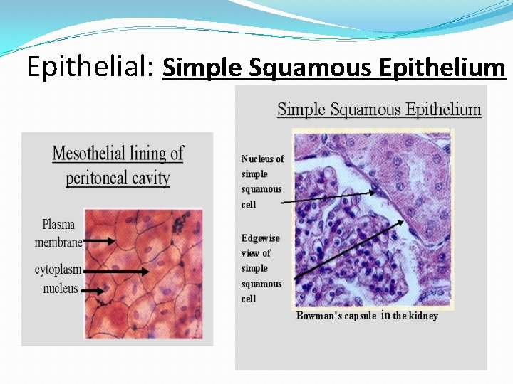 Epithelial: Simple Squamous Epithelium 